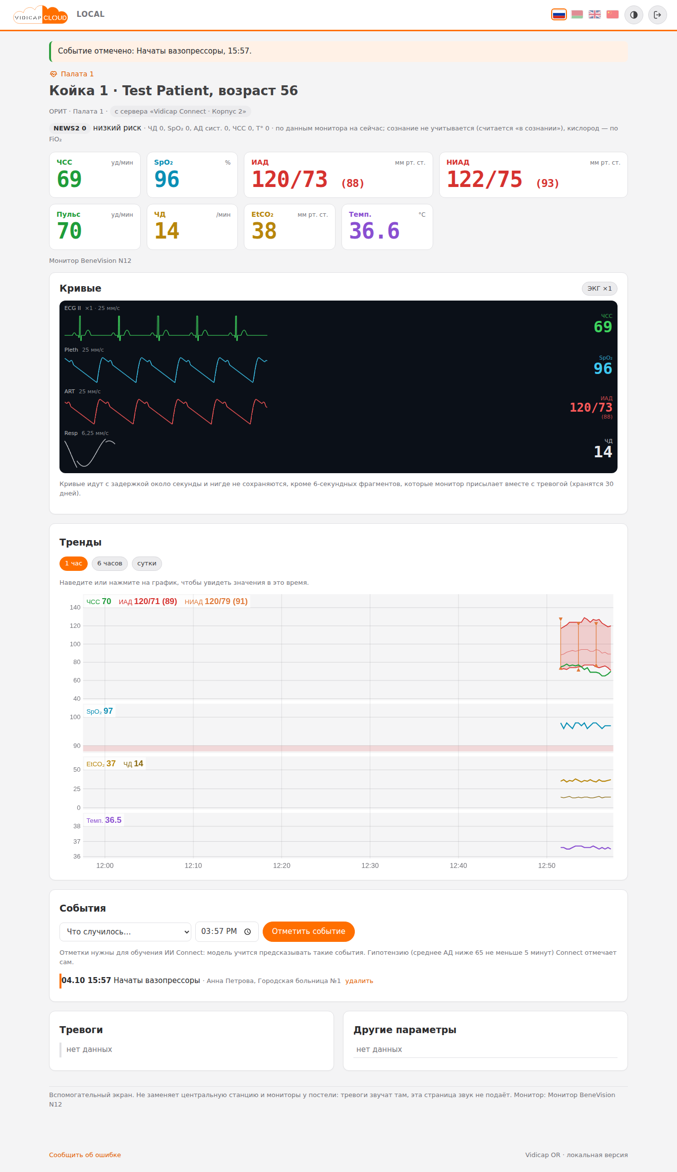 Карточка койки Connect на главном сервере, событие отмечено сверху