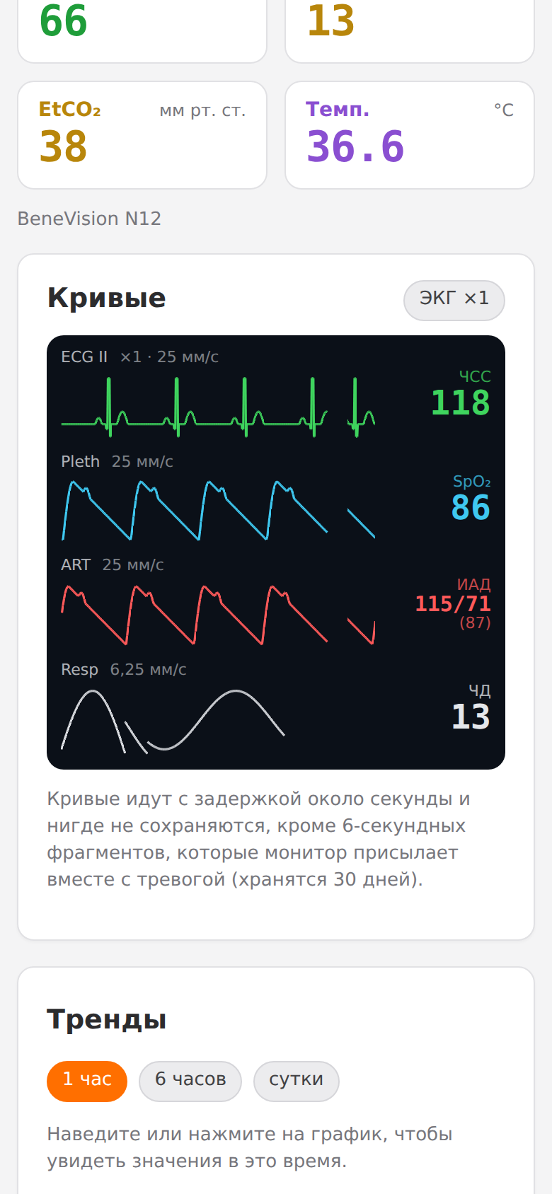 Кривые на телефоне