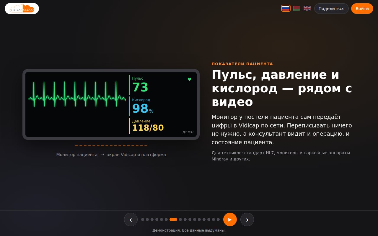 Показатели пациента с монитора