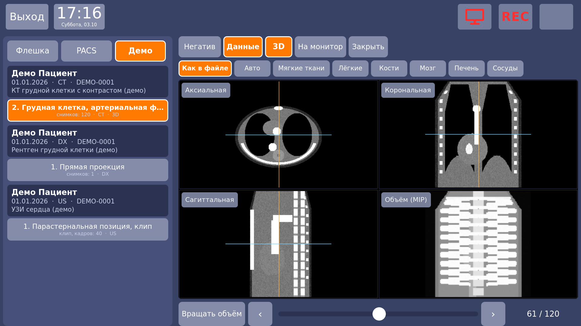 Vidicap Touch 1.0: 3D