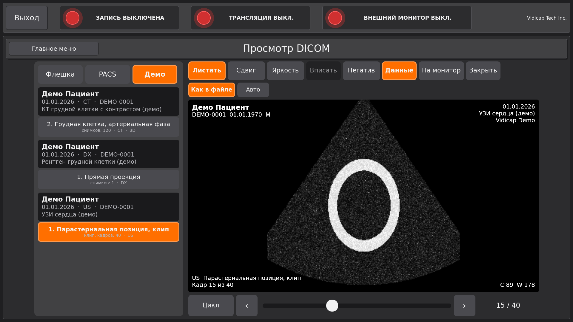Vidicap Touch 2.0: клип УЗИ сердца