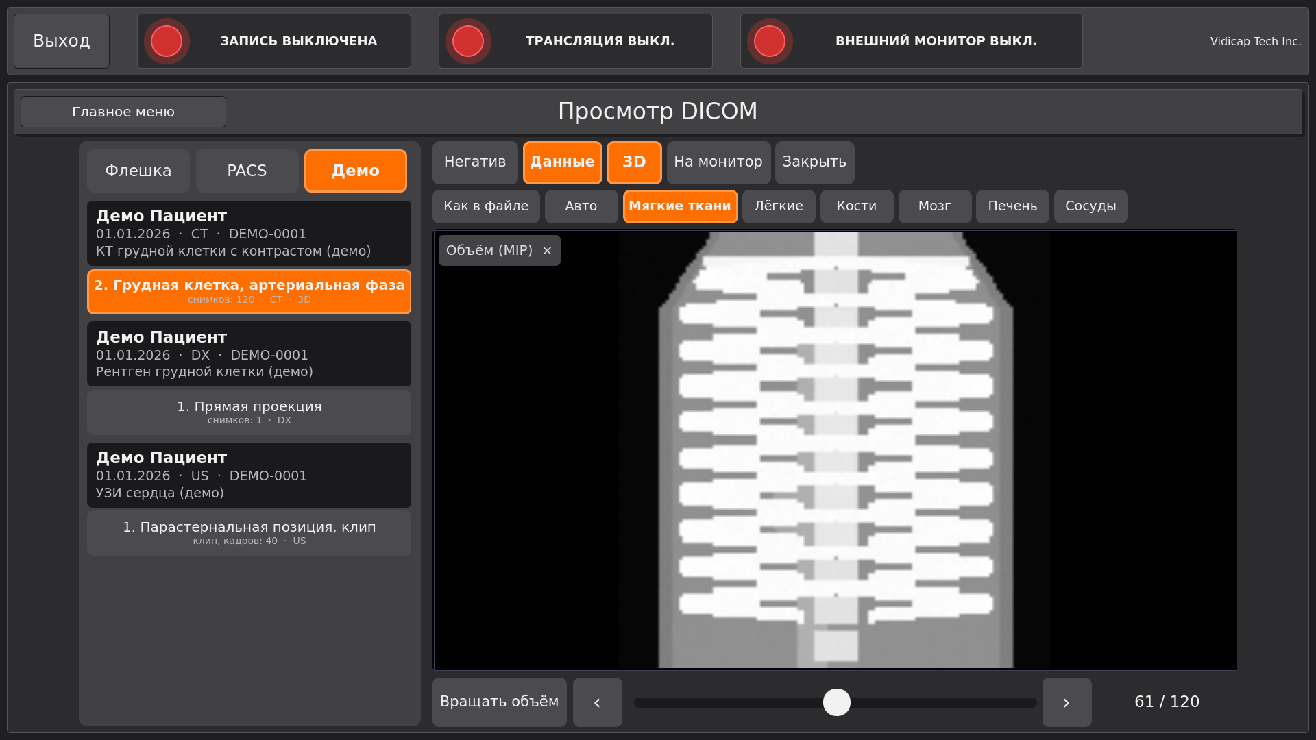 Vidicap Touch 2.0: объём на всю область