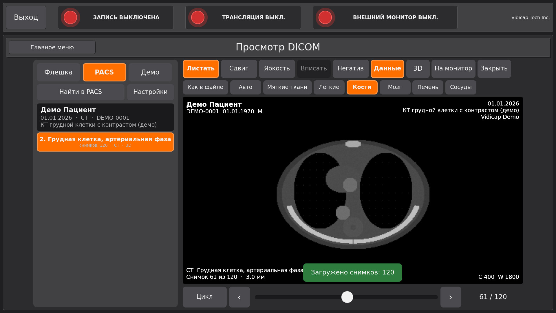 Vidicap Touch 2.0: исследование из PACS открыто