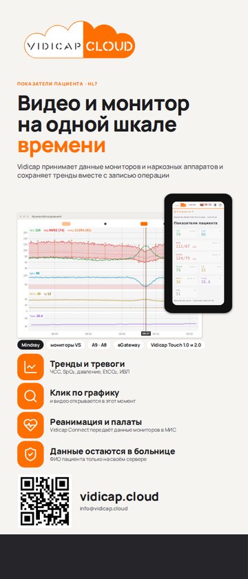 Roll-up “Video and monitor on one timeline”